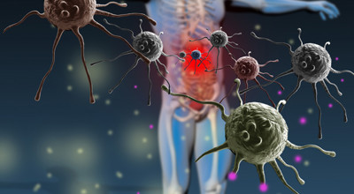 Infecties